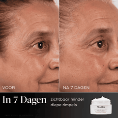 resultaat-in-7-dagen-gladdere-en-gelift-huid