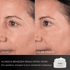 growth-factor-miniproteine-stimuleert-collageenaanmaak