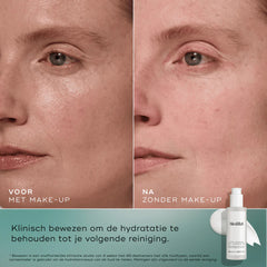Total Moisture Essential Set