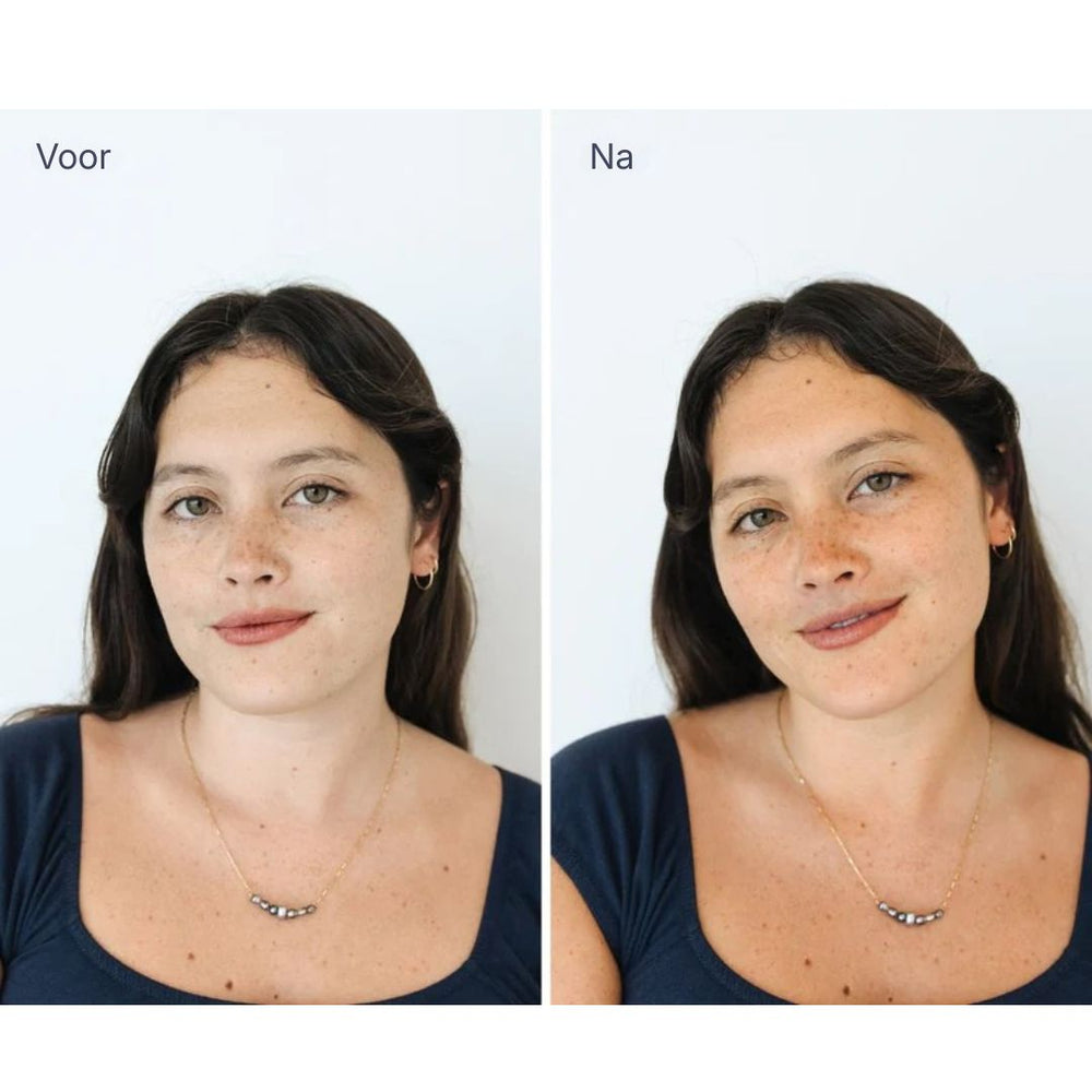 Before en after fotos