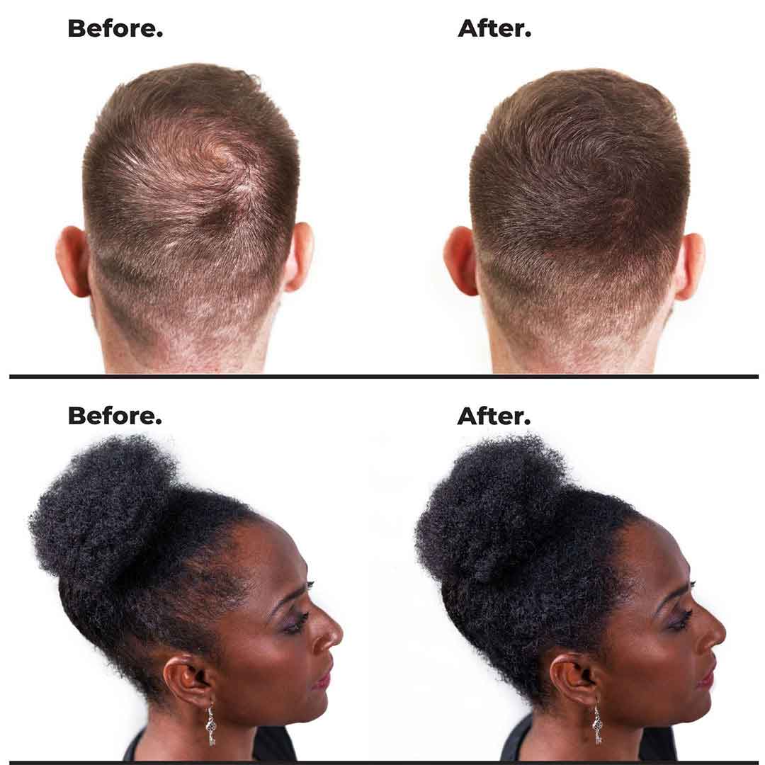 nanogen-hair-fibres-lifestyle-haarstyling