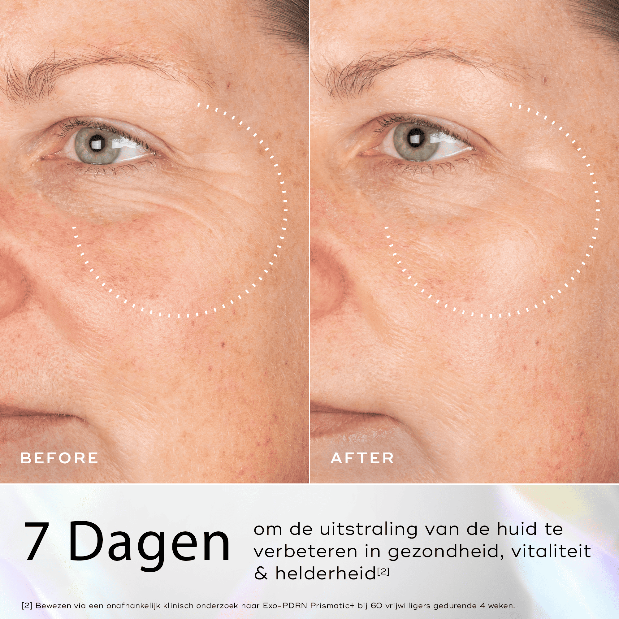 Medik8 PDRN Prismatic before & After