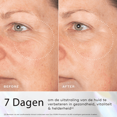 Medik8 PDRN Prismatic before & After