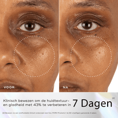 Before & After PDRN Prismatic serum