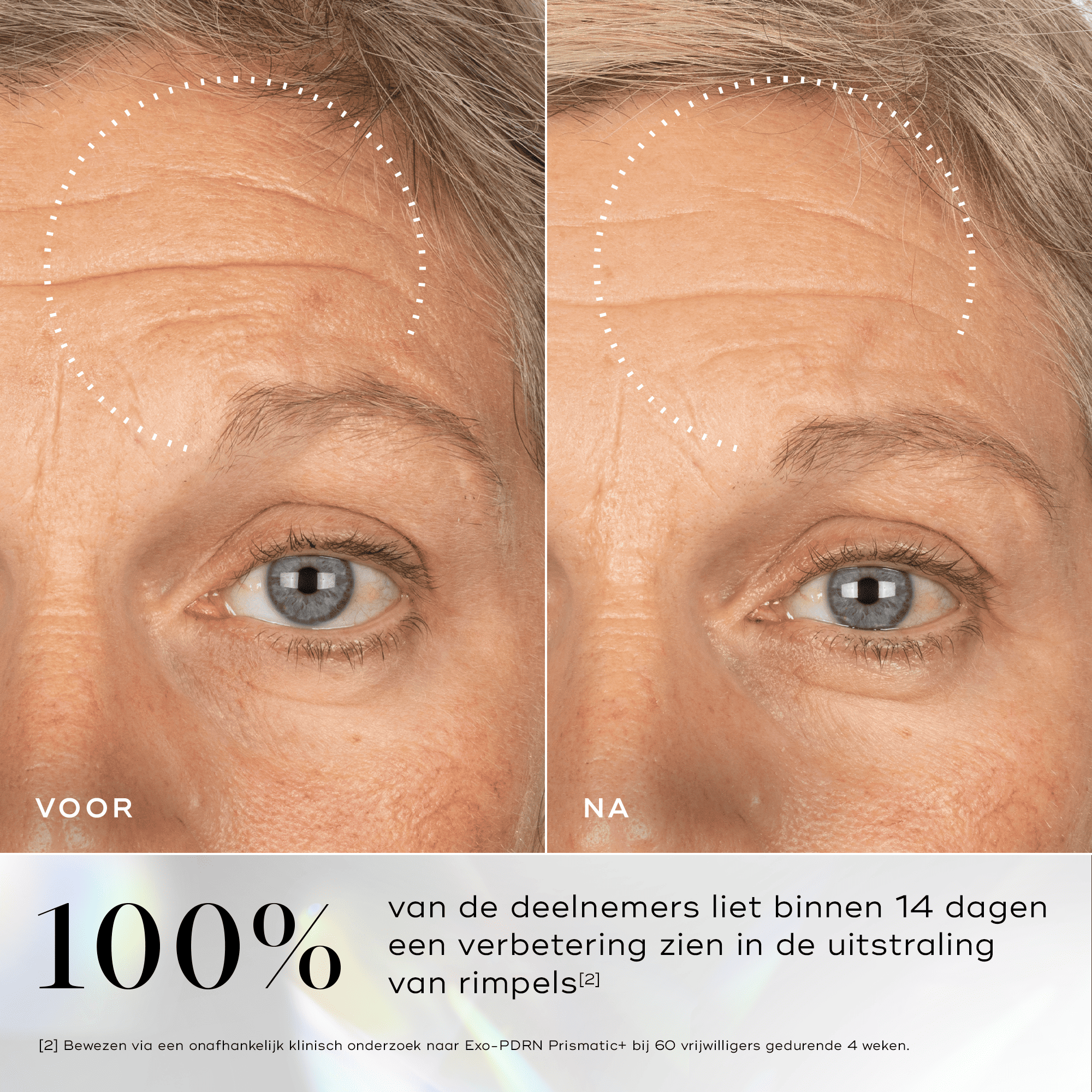 Before & After Medik8 serum