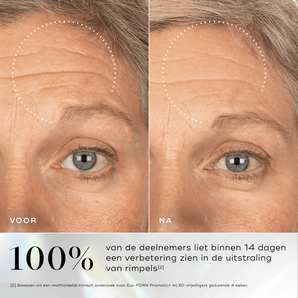 Before & After Medik8 serum