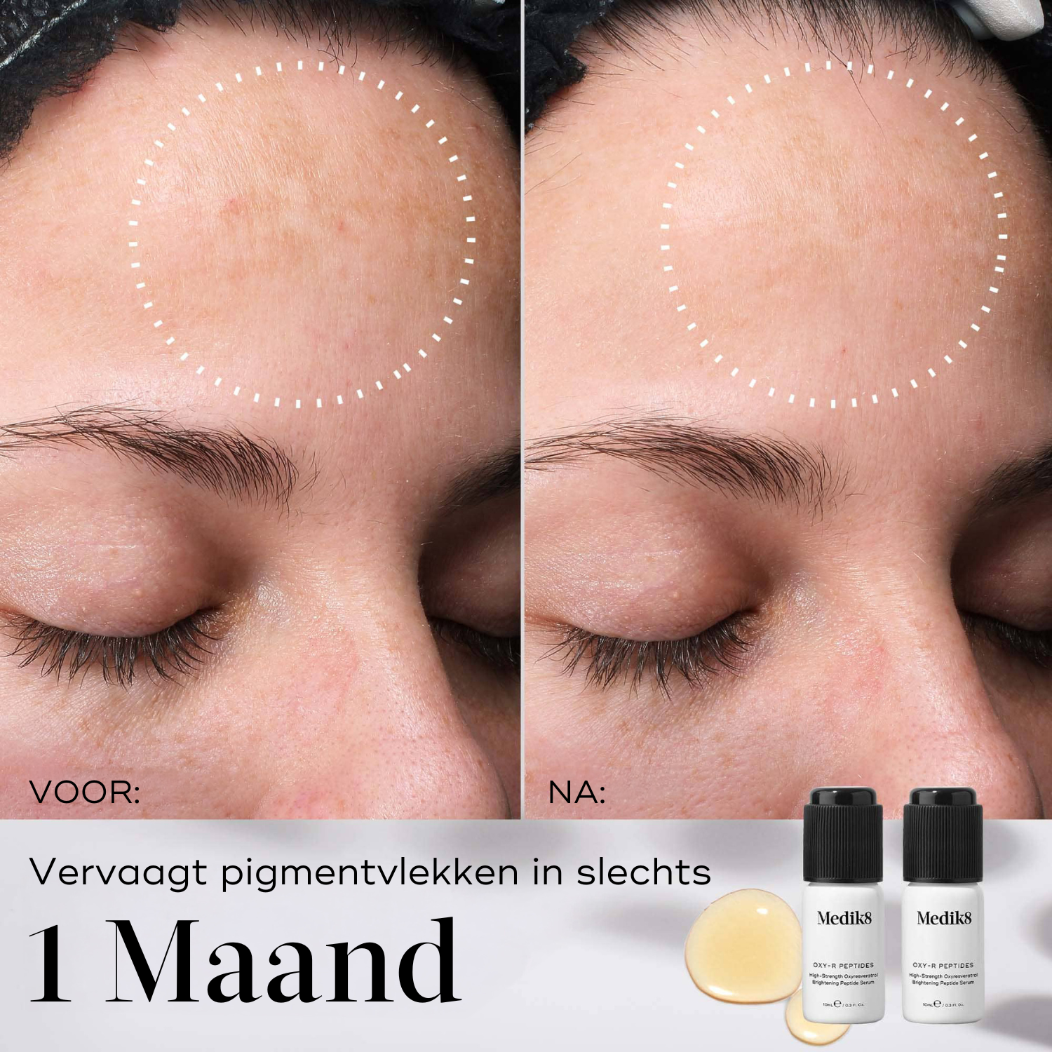 Voor-en-na-gezicht-resultaat