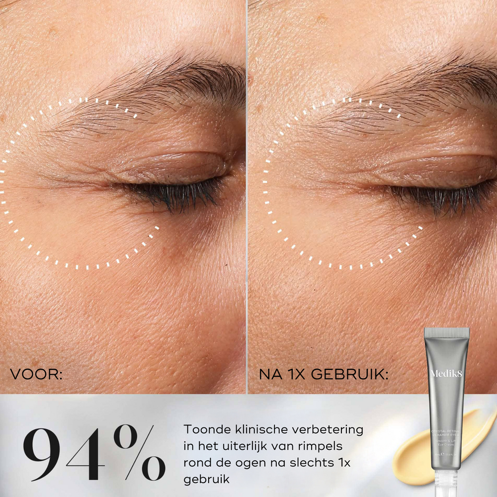 Vitamine-A-oogcrème-stralende-gladde-ogen