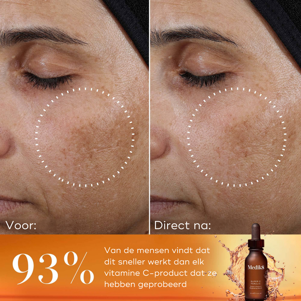 anti-aging-huidverzorging