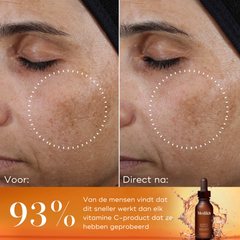 anti-aging-huidverzorging