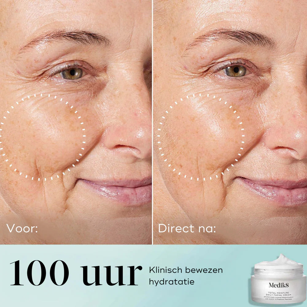 Total Moisture Essential Set